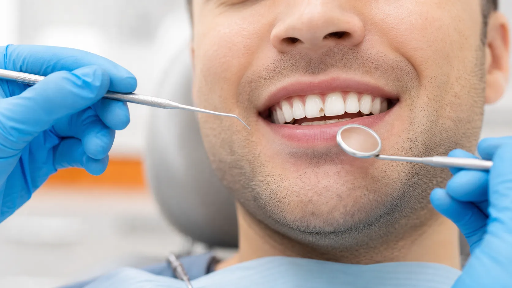 Dientes fracturados treatment